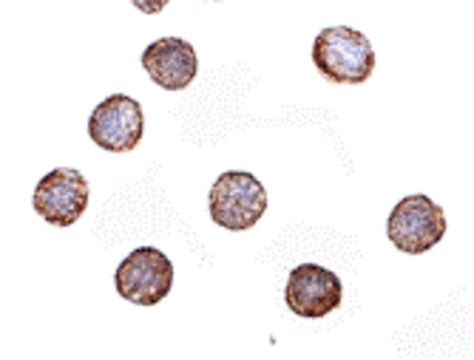 RNAse H2A Antibody - Cat. No. 4979 | ProSci