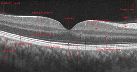 Oct Retinal Layers Labeled