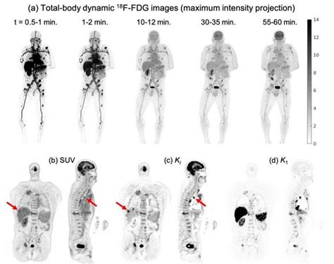 Pet Scan Cancer