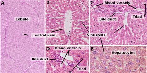 Liver Histology Model Labeled