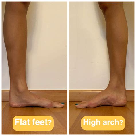 Flat Feet and High Arches: What do they mean?