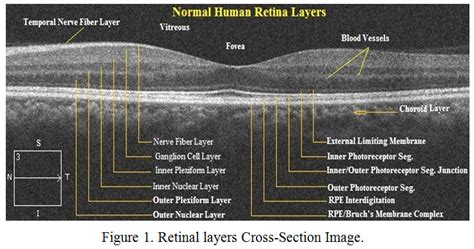 Retinal Layer Segmentation in Pathological SD-OCT Images Using Boisterous Obscure Ratio Approach ...