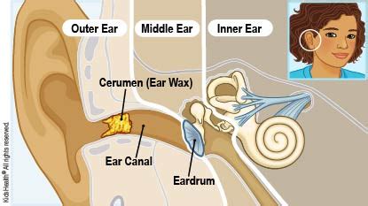 Ear Wax Removal By Doctor