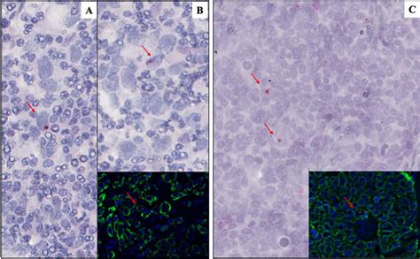 Sensitive in situ detection of EBV by RNAscope assay and... | Download Scientific Diagram