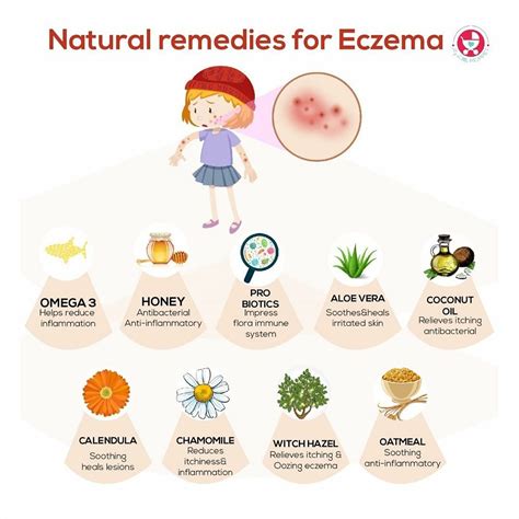 Natural Remedies For Eczema Treatment! - By Dt. Neha Suryawanshi | Lybrate