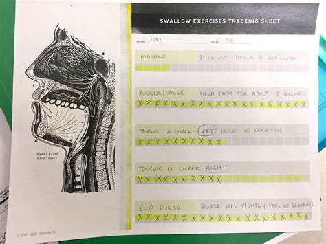 Dysphagia Exercises Tracking – Therapy Insights