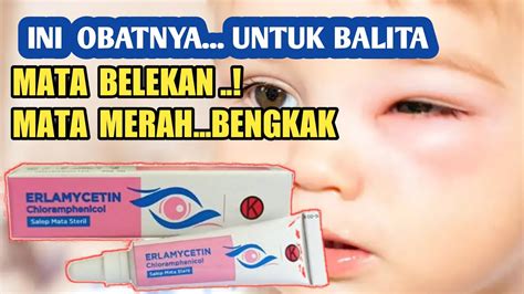 Obat mata untuk bayi salep erlamycetin, mata bengkak mata merah belekan - YouTube