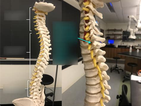 Spinal Nerves Diagram | Quizlet