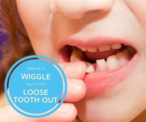 Help Wiggle Your Child’s Loose Tooth Out | Potomac Pediatric Dentistry