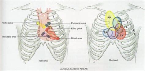 heart landmarks | Cardiac auscultation, Heart sounds, Heart auscultation