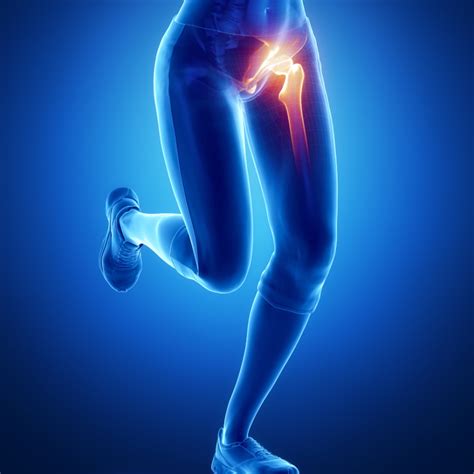 Hip Bursitis - Symptoms, Causes, Treatment | Vitalis Physiotherapy