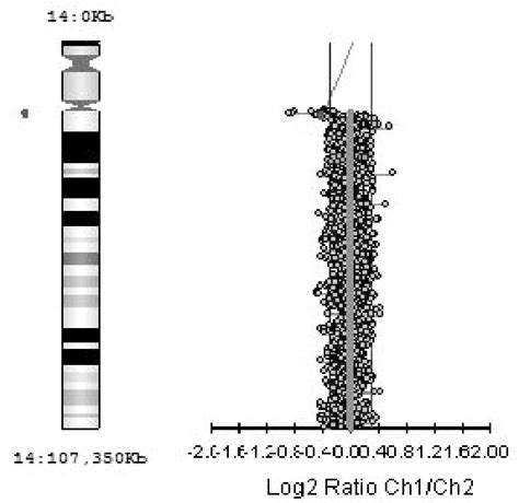 Genomic profile of chromosome 14 in five patients, showing large... | Download Scientific Diagram