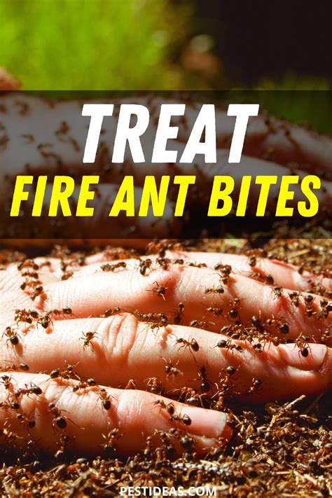 Treat Fire Ant Bites- No More Itch