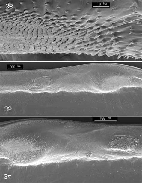 Internal surface of elytra of Normaltica obrieni. 34, right elytron.... | Download Scientific ...