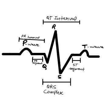 Ecg Waves Labeled | Hot Sex Picture