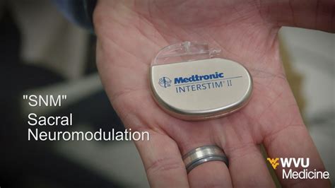 Treating Incontinence with Sacral Neuromodulation - YouTube