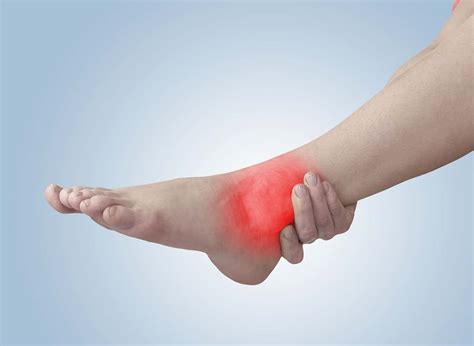 What Is Peroneal Tendonitis? How To Treat It? We Know the Answer!