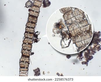 Freshwater Aquatic Zooplankton Algae Under Microscope Stock Photo ...