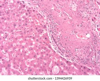 Histology Human Liver Tissue Stock Photo 1394426939 | Shutterstock