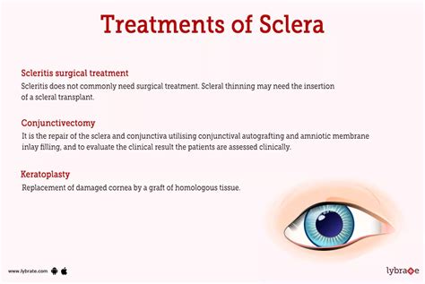 Sclera (Human Anatomy): Image, Functions, Diseases and Treatments