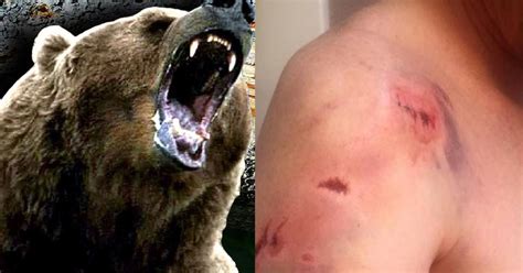 Man posts graphic video, photos showing aftermath of grizzly bear attack | Fox 8 Cleveland WJW