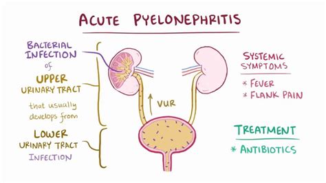 Acute pyelonephritis - Osmosis