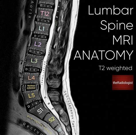 Lumbar Vertebrae Anatomy Xray