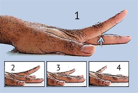 7 Physical Therapy Finger Exercises After Injury | Fort Worth Hand Center