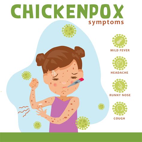 Chicken Pox Symptoms