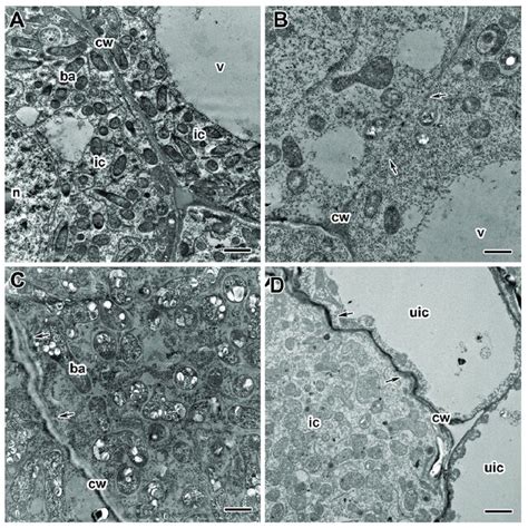 Ultrastructural organization of cell walls in nodules of pea (Pisum... | Download Scientific Diagram