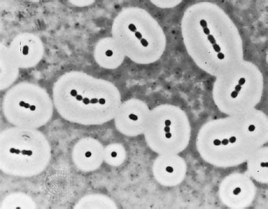 Bacterial Capsule: structure, function and examples of Capsulated ...