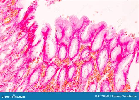 Tissue of Stomach Human Under the Microscope in Lab. Stock Image ...