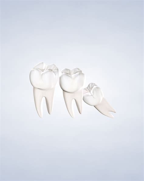 Wisdom Teeth Removal: What to Expect