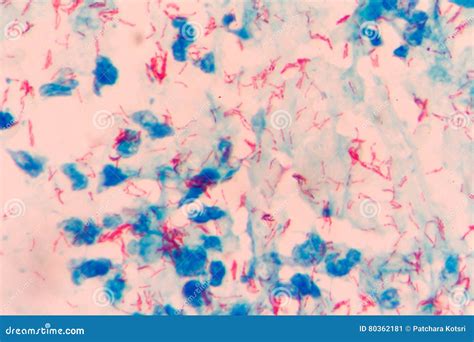 Mycobacterium Tuberculosis Microscope