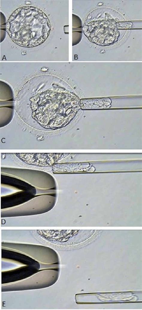 Procedures for one-step blastocyst biopsy. A blastocyst is held to a ...