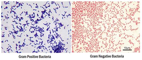 Gram Staining : Principle, Procedure, Interpretation and Animation | LaboratoryInfo.com