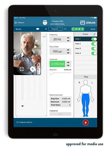 Abbott Introduces NeuroSphere™ Virtual Clinic, First-of-its-Kind Remote Neuromodulation Patient ...