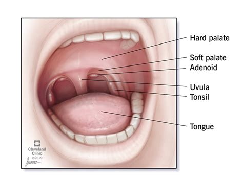 Adenoidectomy (Adenoid Removal): Surgery & Recovery