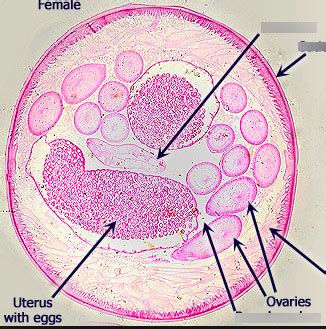 Biology lab 17 practical #2- Ascaris cross section Diagram | Quizlet