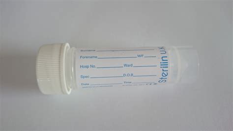 Osmolality (Serum and Urine) / Blood Sciences Test / Exeter Clinical Laboratory International