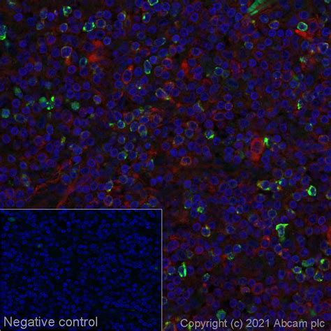 Recombinant Alexa Fluor® 555 Anti-LAG-3 antibody [EPR20261] (ab280858 ...