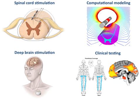 Research – Neuromodulation Laboratory