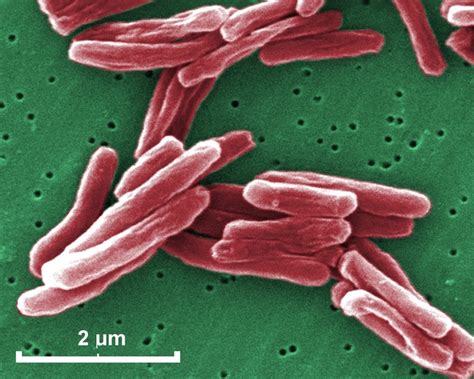 Mycobacterium Tuberculosis Microscope