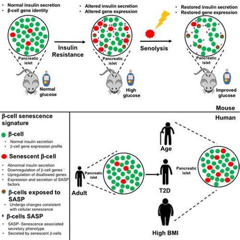 Researchers restore beta-cell function by deleting old cells