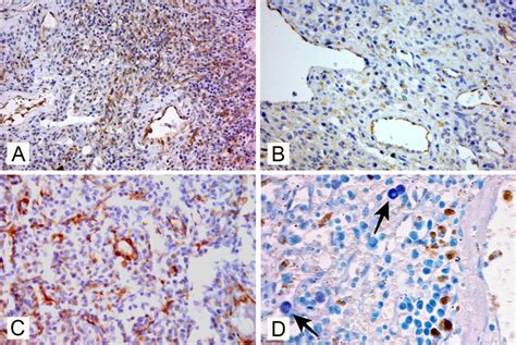 Immunohistochemical expression of the different markers used and the... | Download Scientific ...