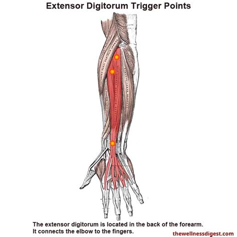 Extensor Digitorum Muscle Pain - The Wellness Digest