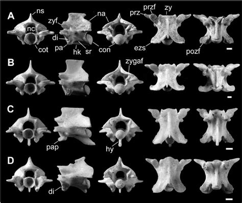 Trunk vertebrae of snakes. (A) referred vertebra of Cyclophiops ...