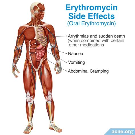 The Side Effects of Antibiotics - Acne.org