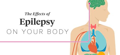 The Effects of Epilepsy on the Body