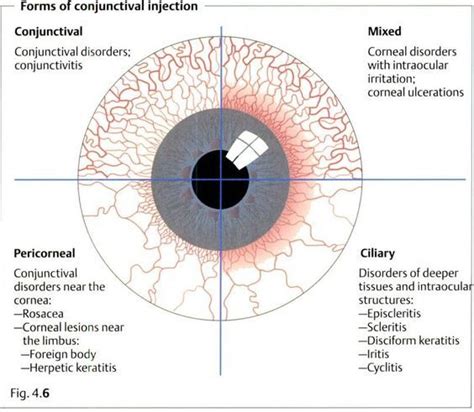 Optometry School, Optometry Students, Opthalmic Technician, Eye Facts, Eye Anatomy, Family Nurse ...